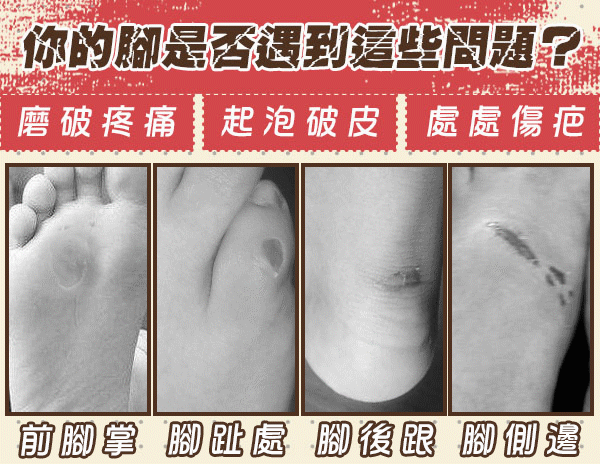 痛點.gif